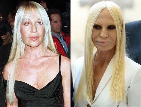 versace sister plastic surgery|donatella versace without make up.